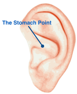 Acupuncture for Weight Loss The Stomach Point